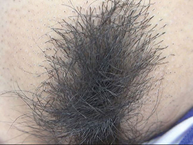 300人のまん毛3 サンプル動画サムネイル